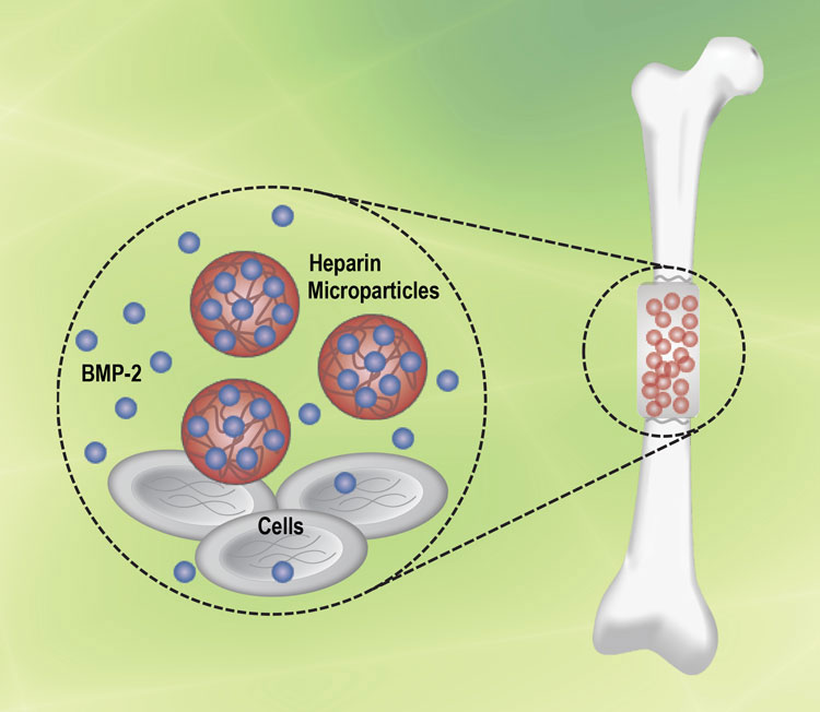 diagram of bone