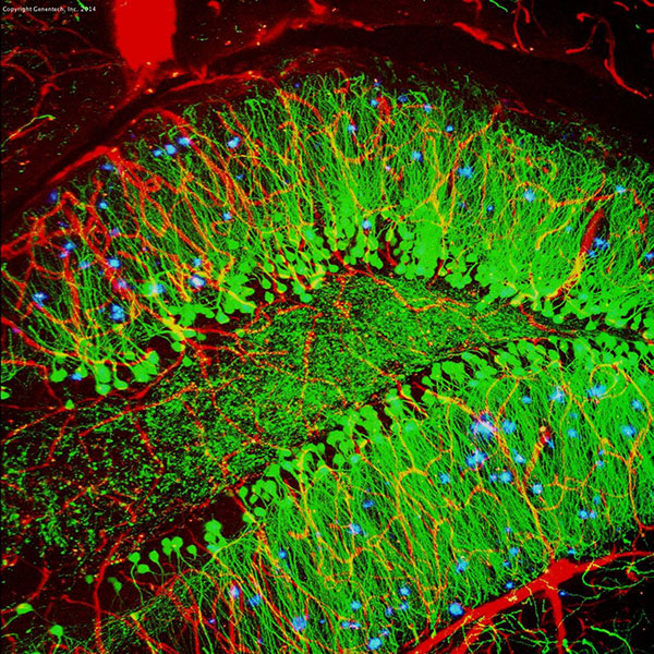 Along with blood vessels (red) and nerve cells (green), this mouse brain shows abnormal protein clumps known as plaques (blue). Georgia Tech / Levy Wood