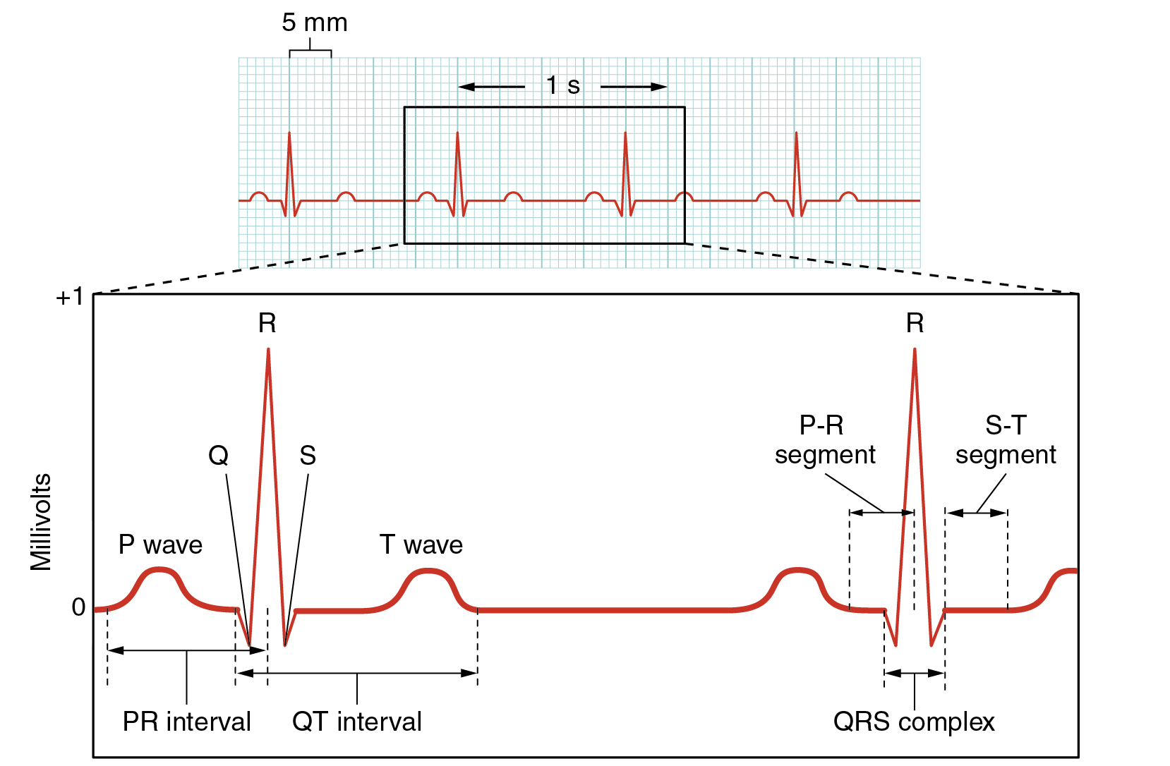 An EKG (ECG) has clearly defined, repetitive waves and is a well-established diagnostic tool. Credit: Creative Commons, Anatomy &amp; Physiology, Connexions Web site. http://cnx.org/content/col11496/1.6 