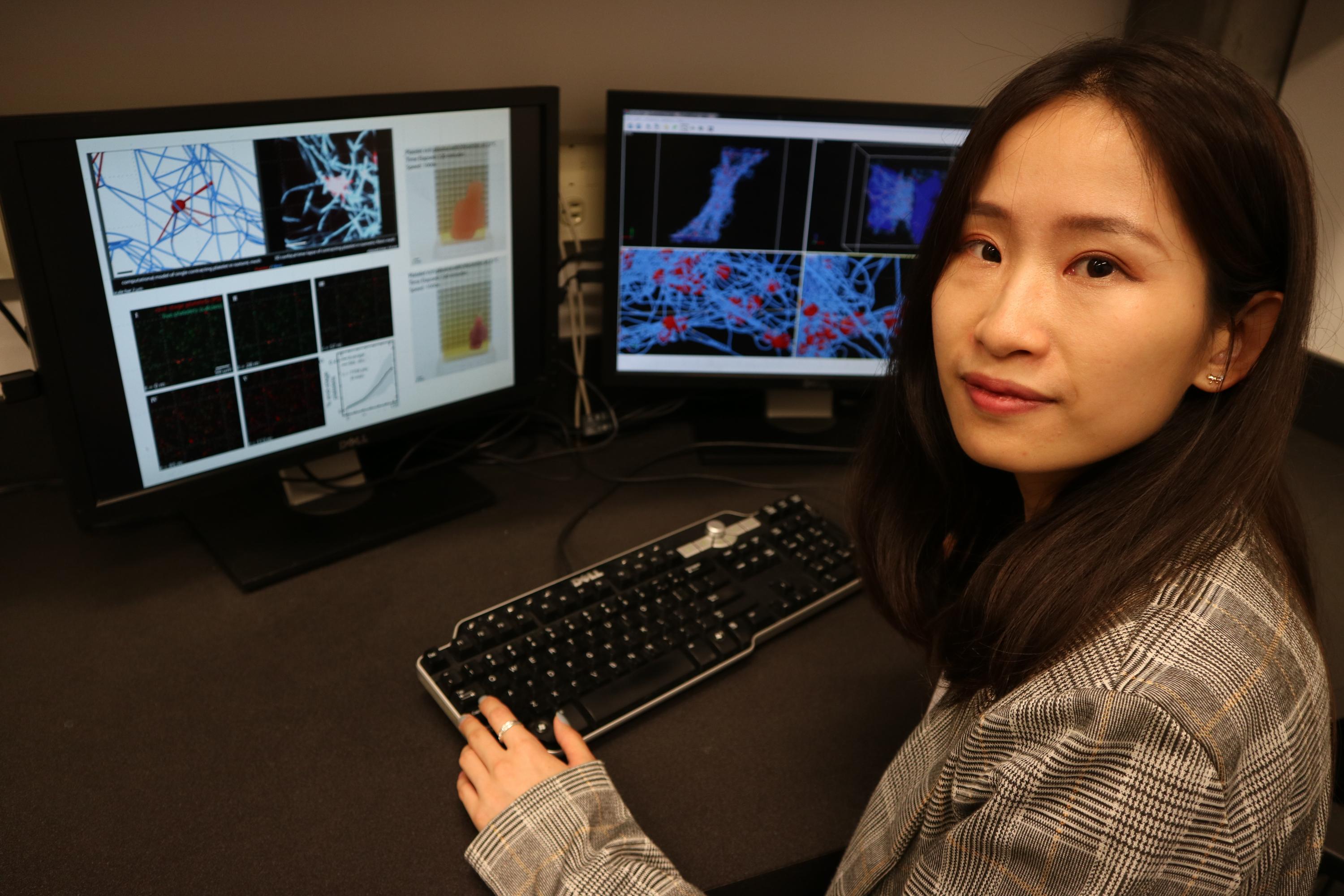 First author Yueyi Sun inside Georgia Tech’s Complex Fluids Modeling and Simulation Lab, where she compares the experimental and simulated platelet-driven fibrin clot contraction process. (Photo Credit: Alexander Alexeev, Georgia Tech)
 