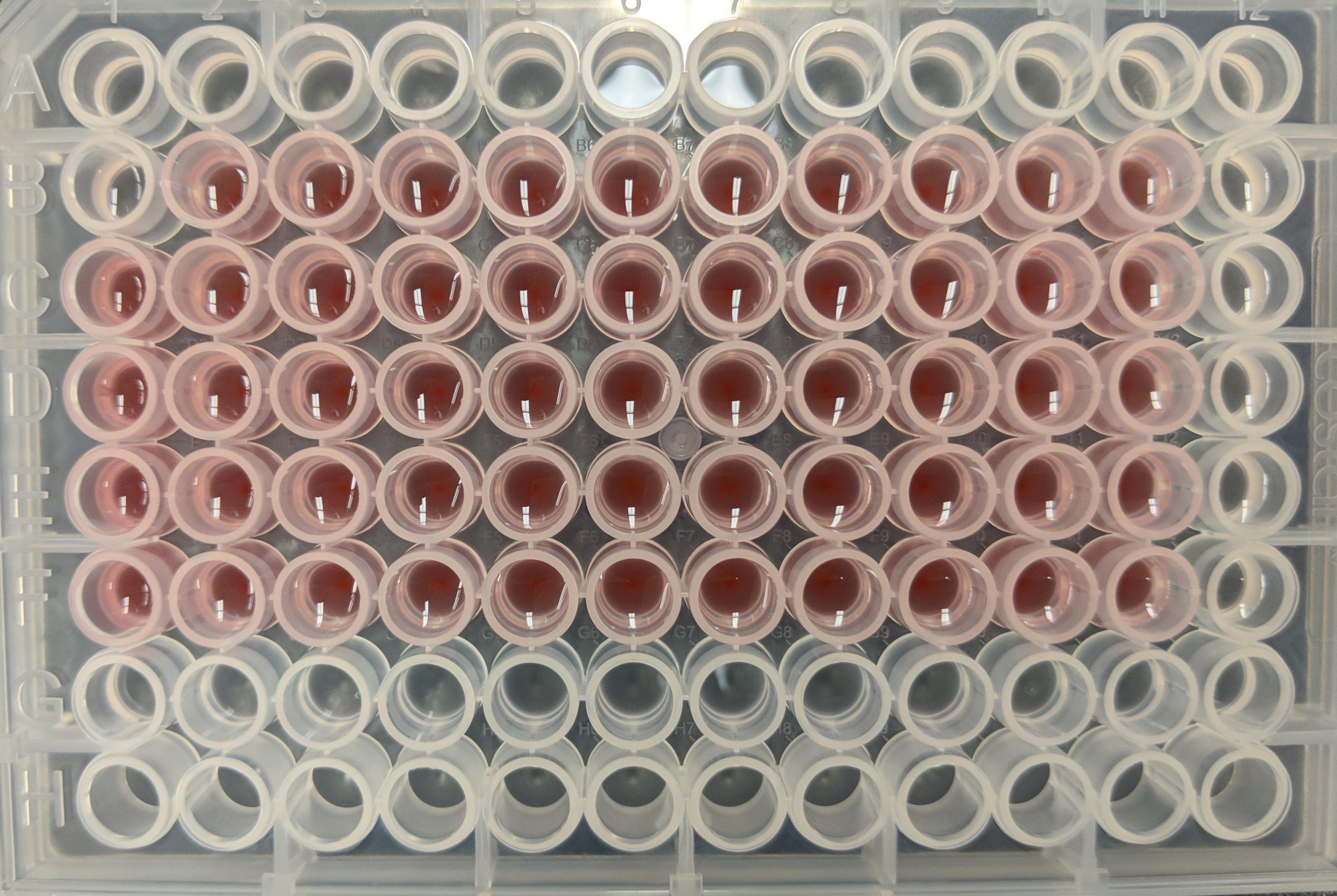 Coral chemical defenses were processed in the lab and tested against a temperature-sensitive pathogen involved in coral bleaching events. Warming tipped the scale in favor of the pathogen. Georgia Tech / Hay lab