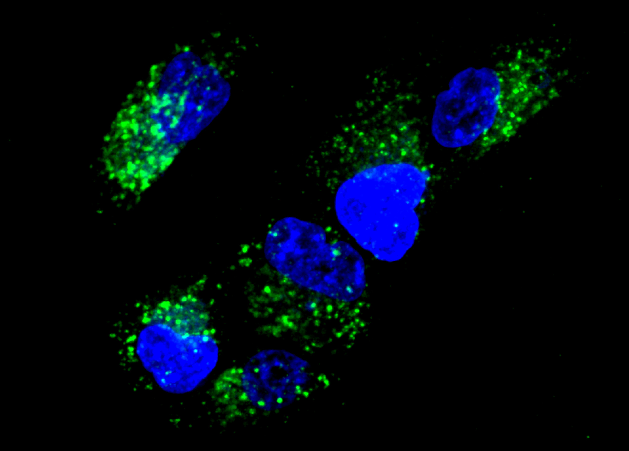 Image shows activation of “AND” gates in cells as observed by fluorescence microscopy. (Credit: Chiara Zurla, Georgia Tech)