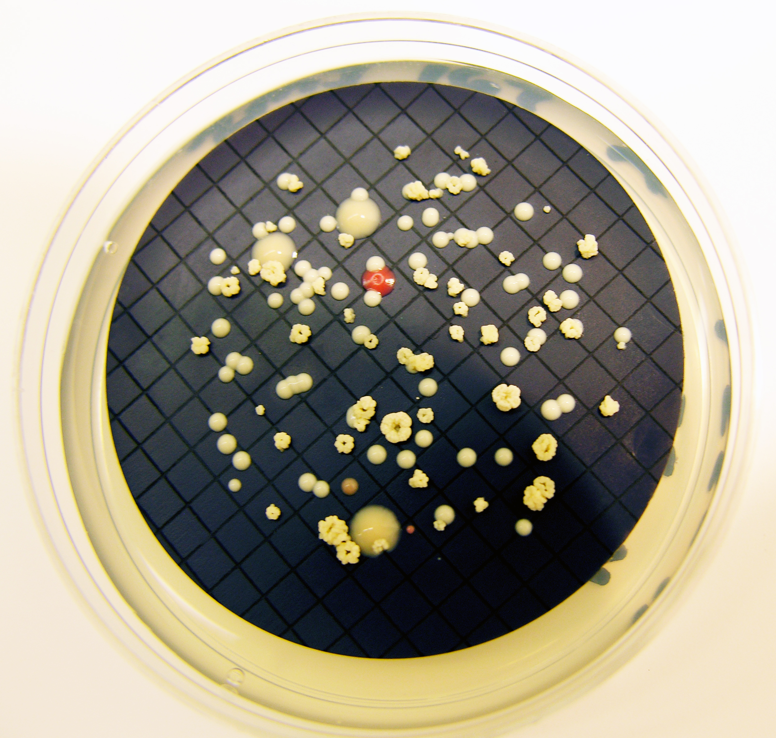 Image shows the growth of Mycobacterium isolated on a plate of culture medium. (Credit: Stacey Pfaller, EPA)