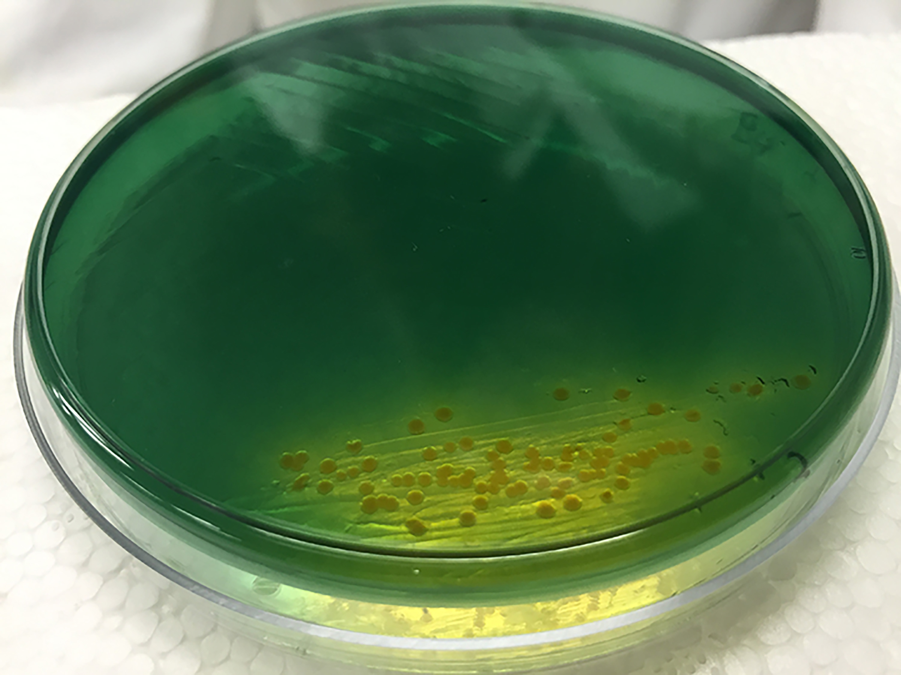 Image shows cholera colonies (yellow) growing on an agar plate. Growth of the bacterium was part of research into the diversity and resourcefulness of the bacterium. (Credit: John Toon, Georgia Tech)