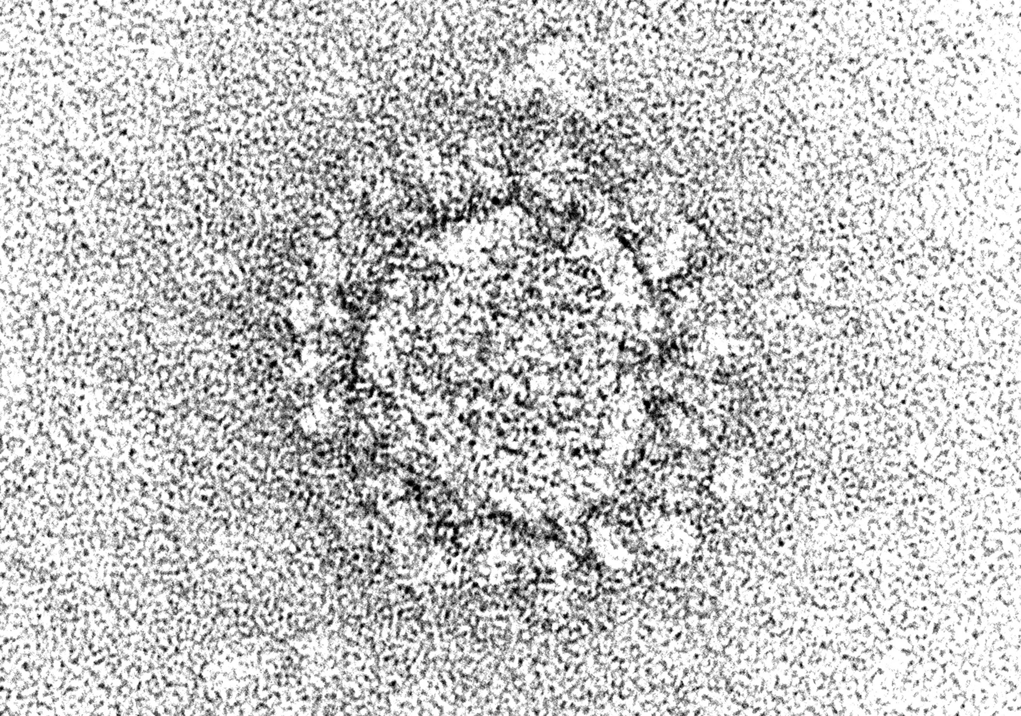 An electron microscope image of a particle of SARS-CoV-2, which is the virus that causes COVID-19. The prominent spikes give the coronavirus its name and are being targeted some efforts to develop a vaccine against it. (Centers for Disease Control and Prevention: Cynthia S. Goldsmith and A. Tamin.)