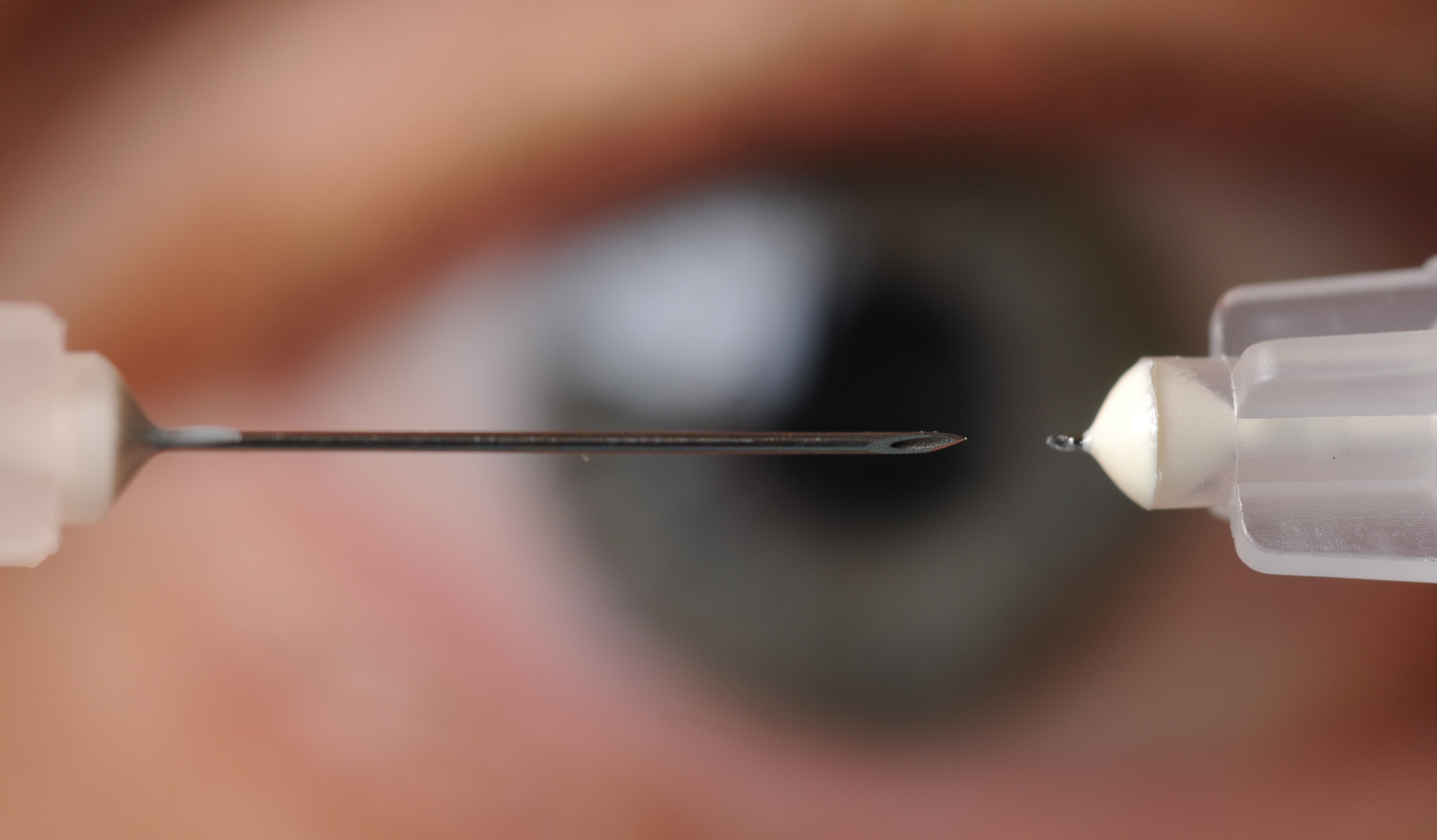 A microneedle used to inject glaucoma medications into the eye is shown next to a conventional hypodermic needle. (Photo credit: Gary Meek).