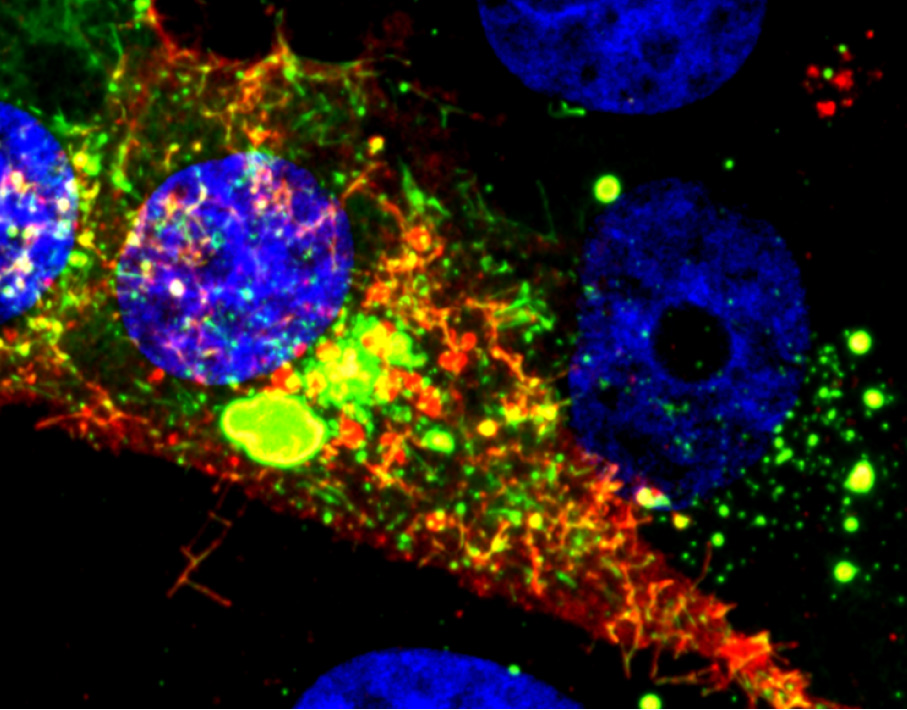 This microscope image shows a cell infected with RSV. The RNA tagged by the probe is shown in red, while the nucleoprotein is green. (Image courtesy of Eric Alonas and Philip Santangelo)