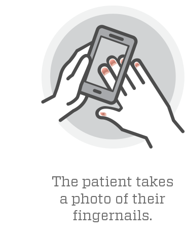 A graphic depiction of the smartphone app that tests for anemia. Credit: Georgia Tech 