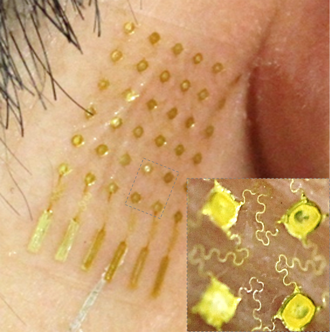 An aerosol-jet printed stretchable, skin-like electrode with an open-mesh structure shown in inset. (Courtesy of Woon-Hong Yeo)