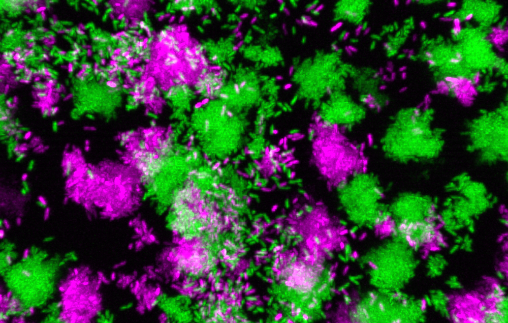 Pseudomonas aeruginosa clumps grown in synthetic cystic fibrosis sputum.&nbsp;
