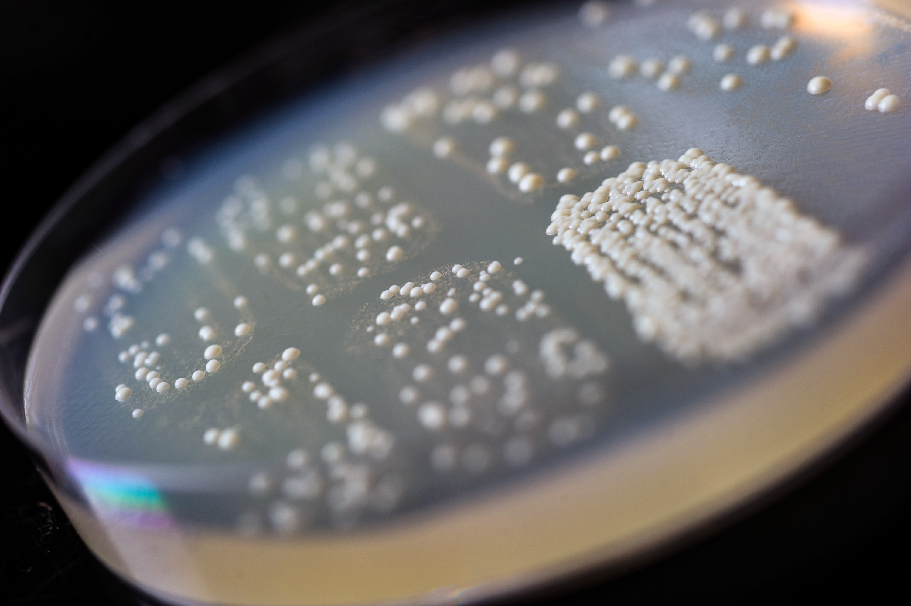 The growth of the budding yeast colonies in the four patches at the bottom of the Petri dish indicates that DNA has been repaired by using transcript RNA from within the cells. (Georgia Tech Photo: Rob Felt)