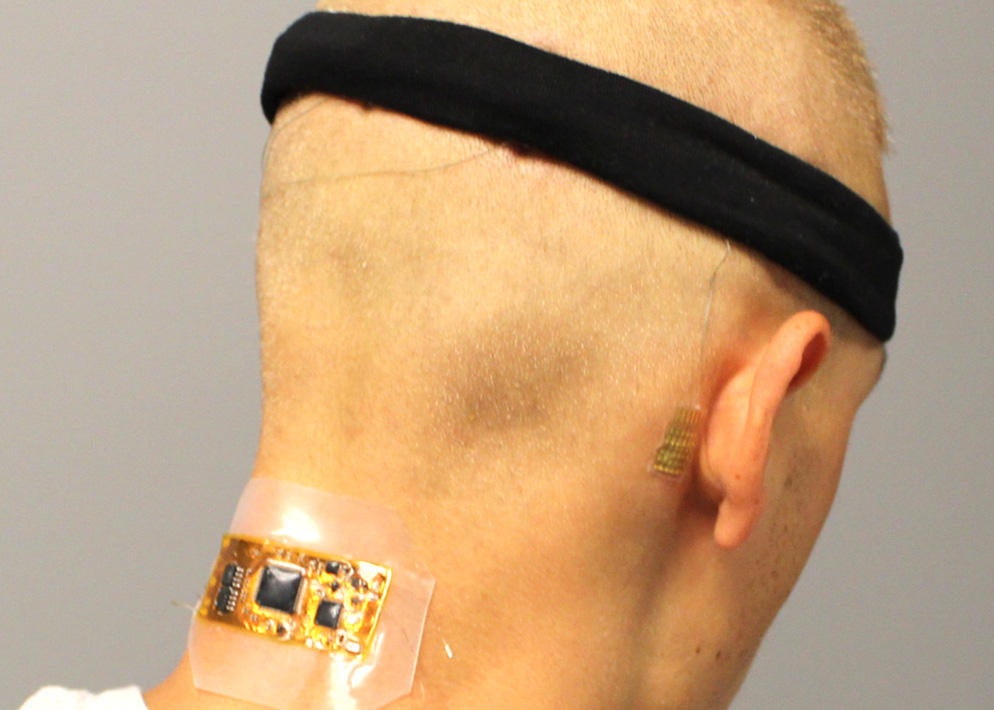 Test subject who has flexible wireless electronics conformed to the back of the neck, with dry hair electrodes under a fabric headband and a membrane electrode on the mastoid, connected with thin-film cables. (Courtesy of Woon-Hong Yeo)