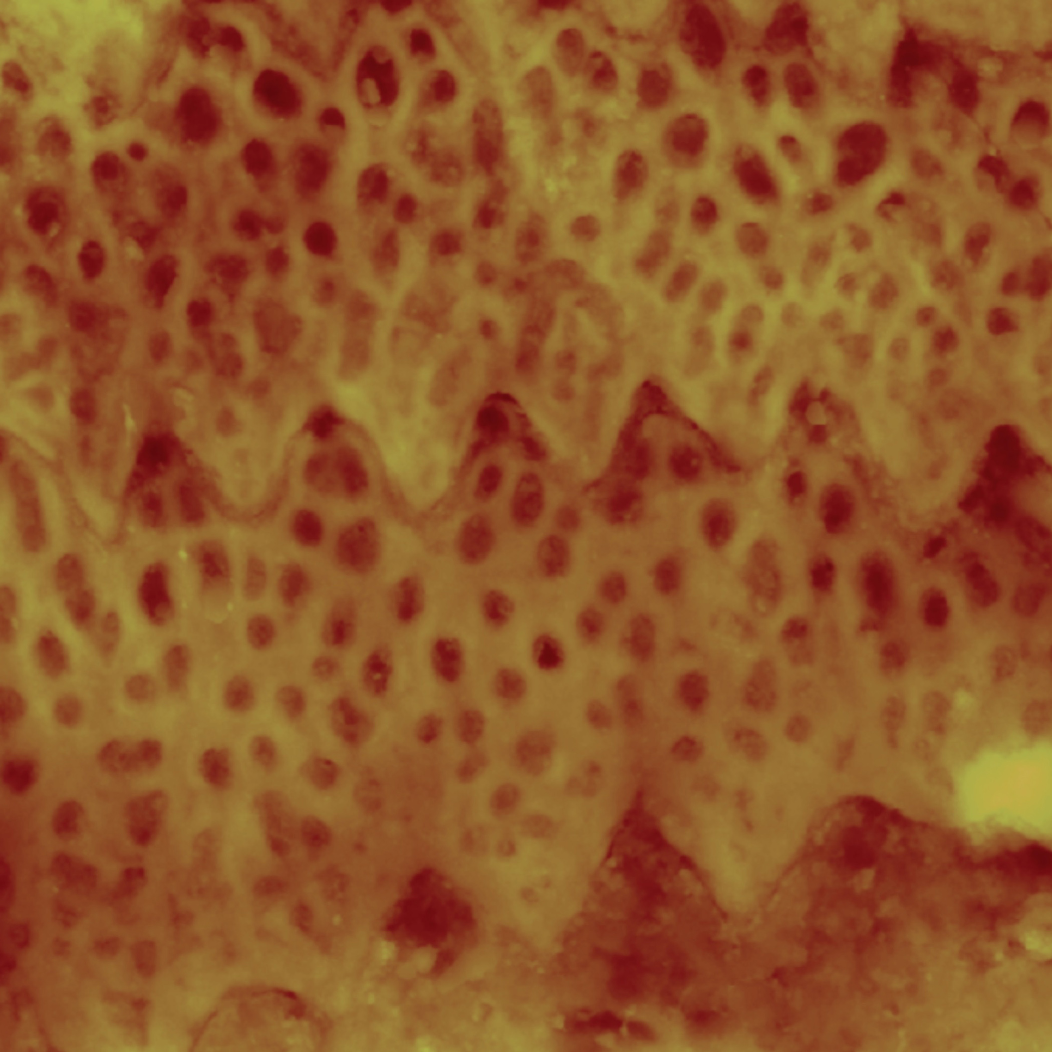 Image shows scale microstructures found on sidewinder snakes. The structures differ from those of other snakes, and researchers believe those differences allow the unique movement of sidewinders on sand. (Credit: Tai-De Li)