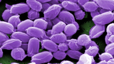 Under high magnification, this digitally-colorized scanning electron microscope image depicts endospores from Bacillus anthracis bacteria. These endospores can live for many years, which enables these bacteria to survive in a dormant state. (CDC image)