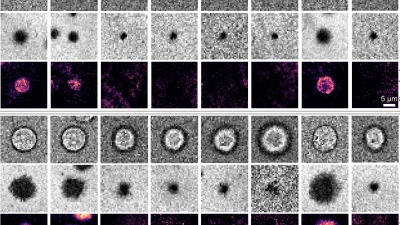 Immune Protein interactions
