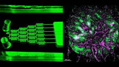 chip organoid.png