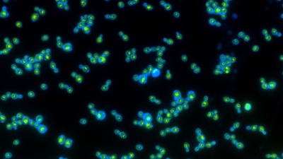 Green rhodopsin proteins inside the blue cell walls help these yeast grow faster when exposed to light. Photo: Anthony Burnetti, Georgia Institute of Technology.
