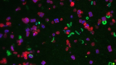 salinibacter ruber.jpeg