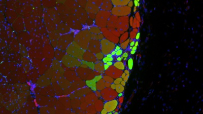  

Hydrogel delivered stem cells called muscle satellite cells integrate to form new muscle strands, in green, along with existing muscle tissue, in red. Yellow strands may descend from existing muscle cells and from delivered MuSCs.