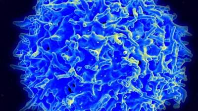 A healthy human T cell. Credit: National Institute of Allergy and Infectious Disease / National Institutes of Health