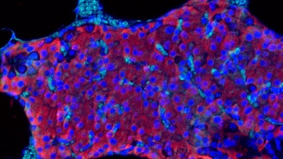 Transplanted pancreatic islet cells in which insulin is shown in red, the cell nucleus in blue, and the blood vessels in aqua.  (Credit: Maria Coronel, Georgia Tech)
