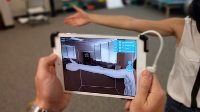 An app and a camera attachment are now all that are needed to check for early onset lymphedema in breast cancer survivors. Credit: LymphaTech / Georgia Tech