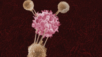 Three T-cells attack a cancer cell in this artist's depiction.

Source: Getty Images / rights not transferable / not a press handout