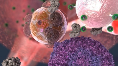 A T cell, here in purple, makes contact with a transplant organ cell, here in reddish brown. The T cell secretes the enzyme granzyme B, here in gray, which attacks the organ cell. But granzyme B also severs fluorescent signal molecules, in green, from the rejection detecting nanoparticle, in light pink. The signal molecules make their way into the urine, where they give off a fluorescent cue. Georgia Tech / EllaMaru Studio (work for hire, all rights GT, free for distribution).
