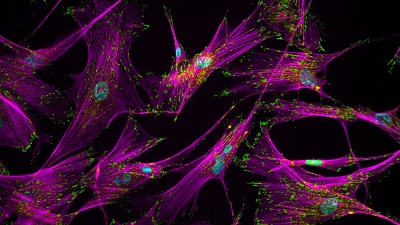 Image shows adult human fibroblast cells with intracellular proteins involved in adhesion of these cells to an extracellular matrix. Magenta represents actin stress fibers in a cell and green staining represents a focal adhesion protein vinculin, which together contribute to how strongly these cells adhere to a matrix surface. Blue is the nucleus of a cell. These fibroblasts are converted to human induced pluripotent stem cells through a reprogramming process during which restructuring of the adhesion prote
