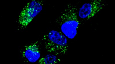 Image shows activation of “AND” gates in cells as observed by fluorescence microscopy. (Credit: Chiara Zurla, Georgia Tech)