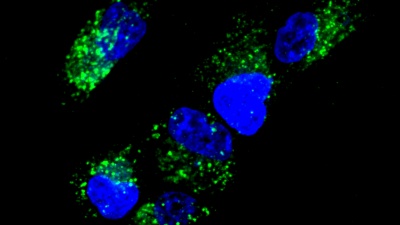 Image shows activation of “AND” gates in cells as observed by fluorescence microscopy. (Credit: Chiara Zurla, Georgia Tech)