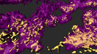 Image shows a rendered confocal laser scanning micrograph of a mixed species bacterial biofilm observed in a chronic wound model of infection. Staphylococcus aureus (yellow) and Pseudomonas aeruginosa (purple), organize themselves in small, dense clusters of cells called aggregates. (Credit: Sophie Darch, Whiteley Lab and Rumbaugh Lab at Texas Tech University Health Sciences Center.)