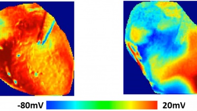 Images show the voltage surface on a rabbit heart with and without HCQ. Without the drug (left) the electrical activation spreads homogeneously, while with HCQ, waves propagate unevenly, generating complex spatiotemporal patterns and arrhythmias.