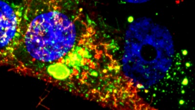 This microscope image shows a cell infected with RSV. The RNA tagged by the probe is shown in red, while the nucleoprotein is green. (Image courtesy of Eric Alonas and Philip Santangelo)