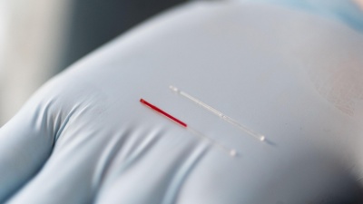 Interstitial fluid (right) may provide an alternative source of biomarkers compared to blood (left) that could be useful in diagnosing human illness. (Credit: Allison Carter, Georgia Tech)
