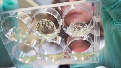 Jessica Weaver, a postdoctoral researcher in Georgia Tech’s Woodruff School of Mechanical Engineering, holds a multiwell plate containing hydrogels with pancreatic islet cells. (Credit: Christopher Moore, Georgia Tech)