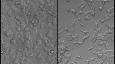 Pictured are MCF-7 human breast cancer cells, stably transformed with SNAIL (right) or an empty vector control (left). Cells expressing SNAIL show an increased mesenchymal phenotype and malignant characteristics. The control cells display a cobblestone morphology, whereas cells overexpressing SNAIL are more elongated. Credit: MgGrail, et al., FASEB 2014.