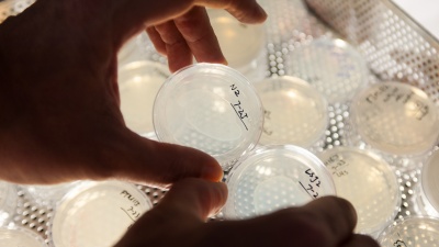 Patrick McGrath holds up dishes with two lab strains of the C. elegans roundworm. Strain LSJ2 (dish on right) dramatically changed its survival strategy to live longer and have fewer offspring due to a tiny mutation on its NURF-1 gene. Researchers at Georgia Tech confirmed the effects of the mutation by duplicating it in lab strain N2 (dish on left) via an injection with CRISPR Cas9. 