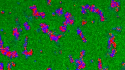 Visualization shows the microgel network architecture in fibrin–microgel composite materials. Confocal microscopy images of fluorescently labeled microgels (shown in blue and red) and fibrin (shown in green) demonstrate that at a critical volume fraction, the microgels form an interconnected tunnel network within the fibrous fibrin matrix. Microgels are tightly packed and only slightly jiggle around within the microgel domains. (Credit: Alison Douglas)