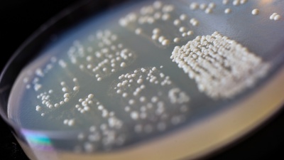 The growth of the budding yeast colonies in the four patches at the bottom of the Petri dish indicates that DNA has been repaired by using transcript RNA from within the cells. (Georgia Tech Photo: Rob Felt)