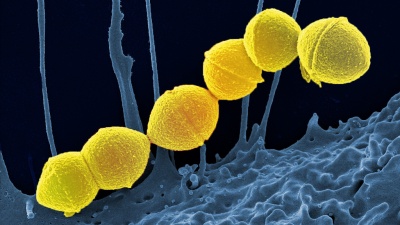 Group A Streptococci, colored yellow, are the most common culprits in bacterial upper respiratory infections. Credit: National Institute of Allergy and Infectious Diseases of the NIH